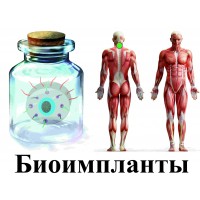 Видеосистема - Биоимпланты