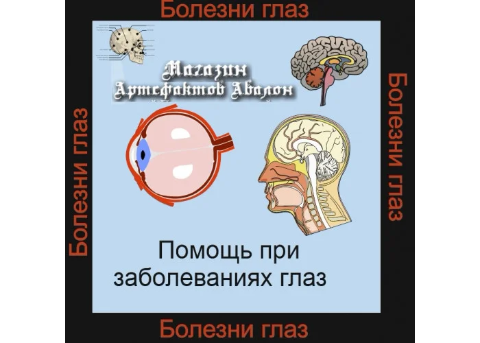 Аудиосистемы-ЦелительскиеиНормализующие-ПомощьпризаболеванияГлаз